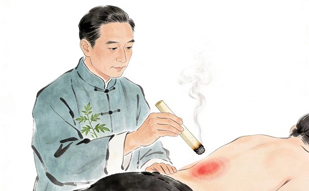 大寒时节精神差易抑郁——泰和灸温阳散寒护阳气